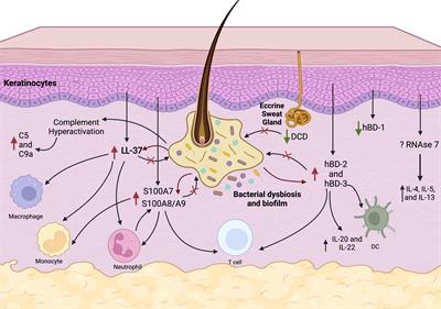 Innate immunity and microbial dysbiosis in hidradenitis suppurativa – vicious cycle of chronic inflammation